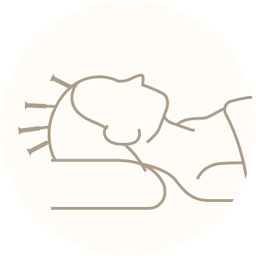 小顔鍼のイメージイラスト